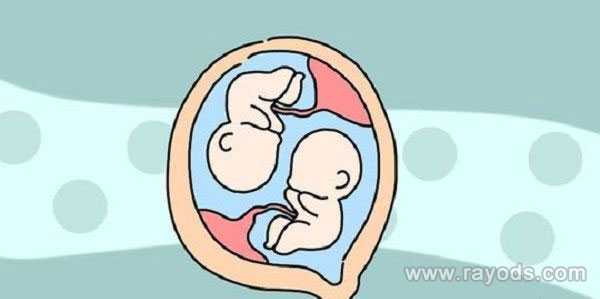 代生一个孩子多少钱，双胞胎会不会同时胎停？双胞胎胎停症状有哪些症状
